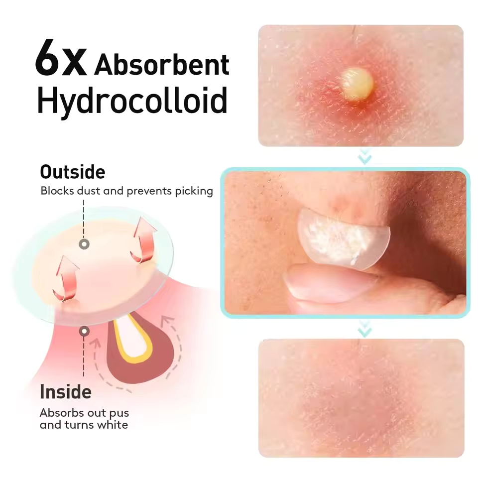 360 pièces/boîte patchs contre - Essential Oils avis et prix